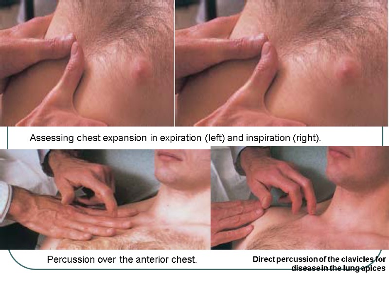 Assessing chest expansion in expiration (left) and inspiration (right).   Direct percussion of